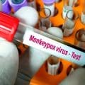 monkeypox effects