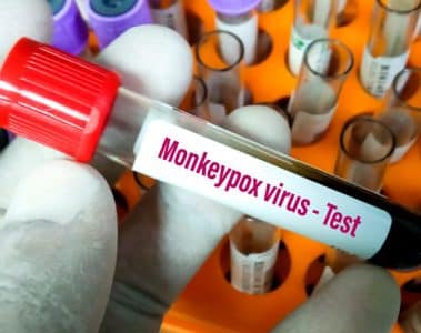 monkeypox effects