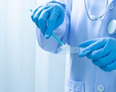 what is pap smear