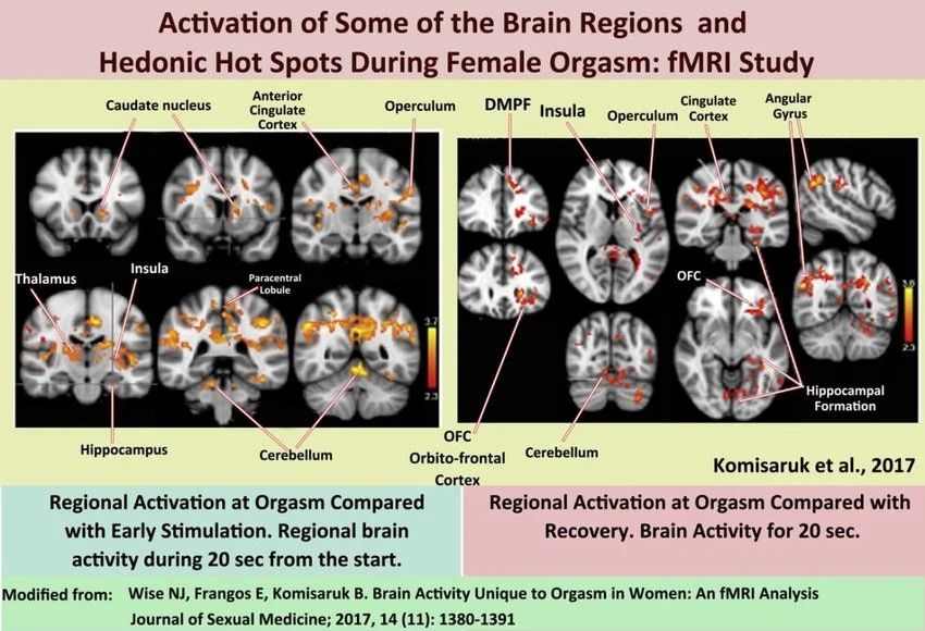 female orgasm brain activity
